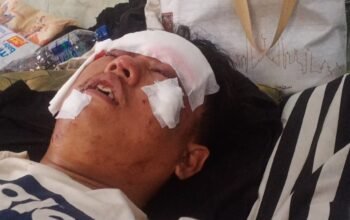 Masih Menghirup Udara Segar Tersangka Berli Okivansyah Kasus Penganiayaan, Diduga Polsek Kikim Timur Tidak Profesional