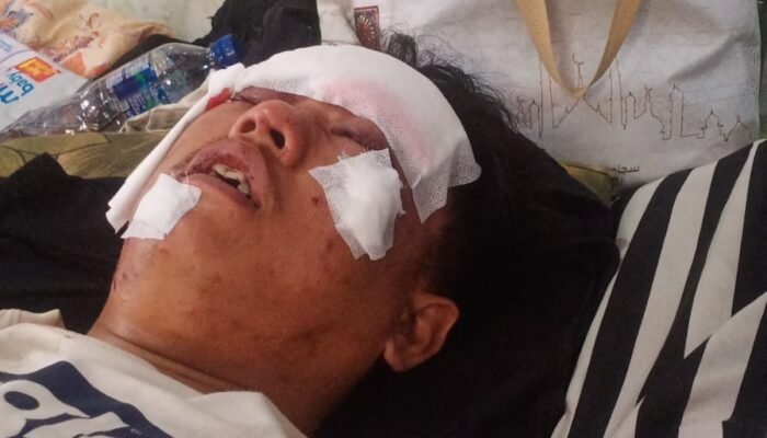 Masih Menghirup Udara Segar Tersangka Berli Okivansyah Kasus Penganiayaan, Diduga Polsek Kikim Timur Tidak Profesional